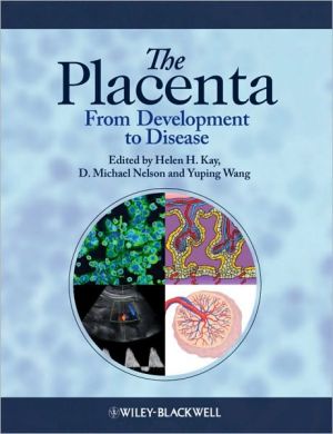 The Placenta: From Development to Disease