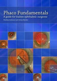 Phaco Fundamentals: A Guide for Trainee Ophthalmic Surgeons | ABC Books