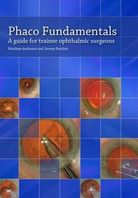 Phaco Fundamentals: A Guide for Trainee Ophthalmic Surgeons