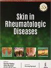Skin in Rheumatologic Diseases | ABC Books