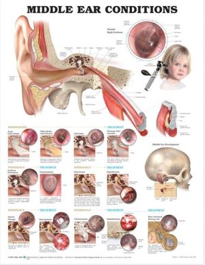 Middle Ear Conditions Anatomical Chart, 2e | ABC Books