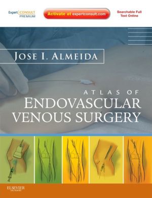 Atlas of Endovascular Venous Surgery **