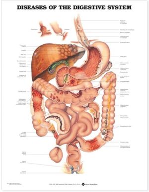 Diseases of the Digestive System Chart