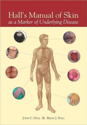 Hall's Manual of Skin As a Marker of Underlying Disease | ABC Books