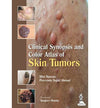 Clinical Synopsis and Color Atlas of Skin Tumors | ABC Books