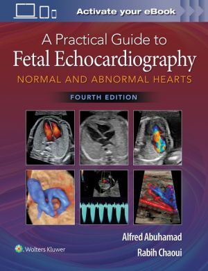 A Practical Guide to Fetal Echocardiography: Normal and Abnormal Hearts, 4e | ABC Books