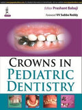 Crowns in Pediatric Dentistry | ABC Books