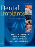 Dental Implants, 2e