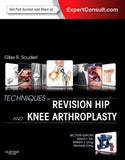 Techniques in Revision Hip and Knee Arthroplasty | ABC Books