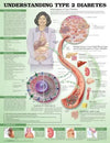 Understanding Type 2 Diabetes Anatomical Chart, 3e | ABC Books