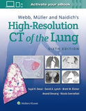 Webb, Müller and Naidich's High-Resolution CT of the Lung, 6e | ABC Books